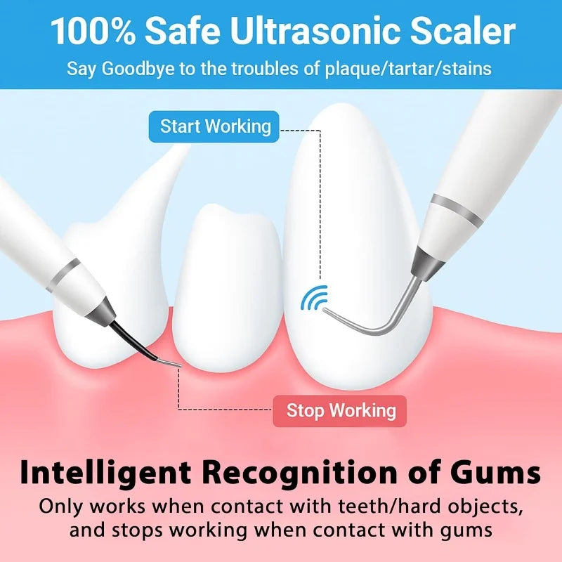 Dog Cat Grooming Smart Dental Ultrasonic Scaler Household Tooth Stone Remover Tooth CleanerTooth Whitening Oral Cleaning Tools